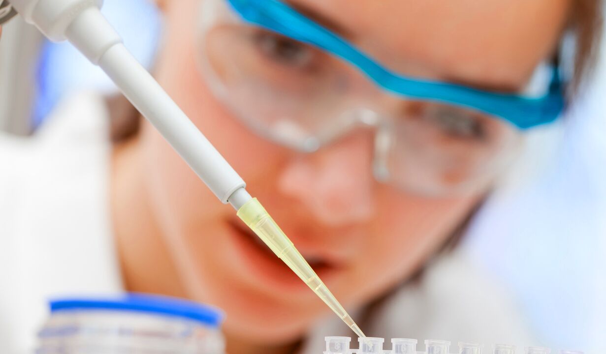 Laboratoire Analyse vum Urin - eng Method fir d'Diagnostik vun der Prostatitis