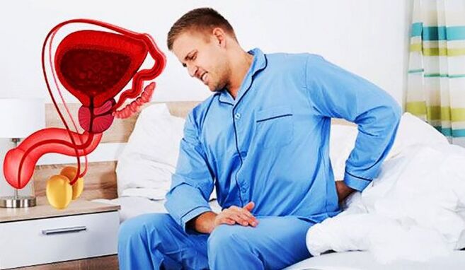 Schmerz am ënneschte Réck wéinst Prostatitis