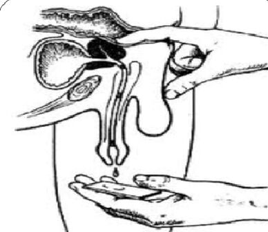 Prostata Massage fir Sekretioun