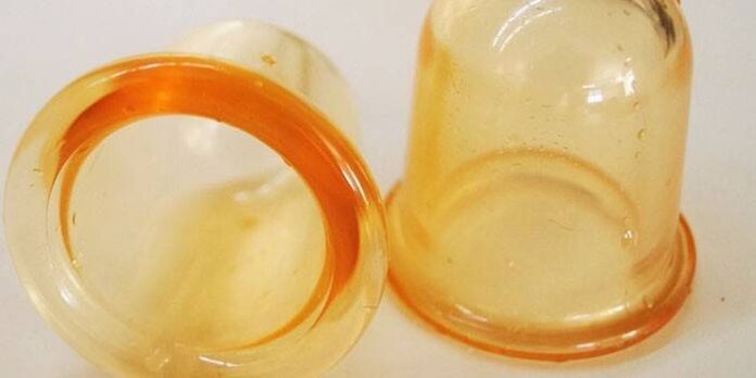 Banken fir d'Behandlung vu Prostatitis